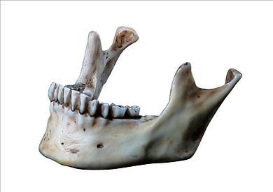 1766-2441 Menschlicher Unterkiefer